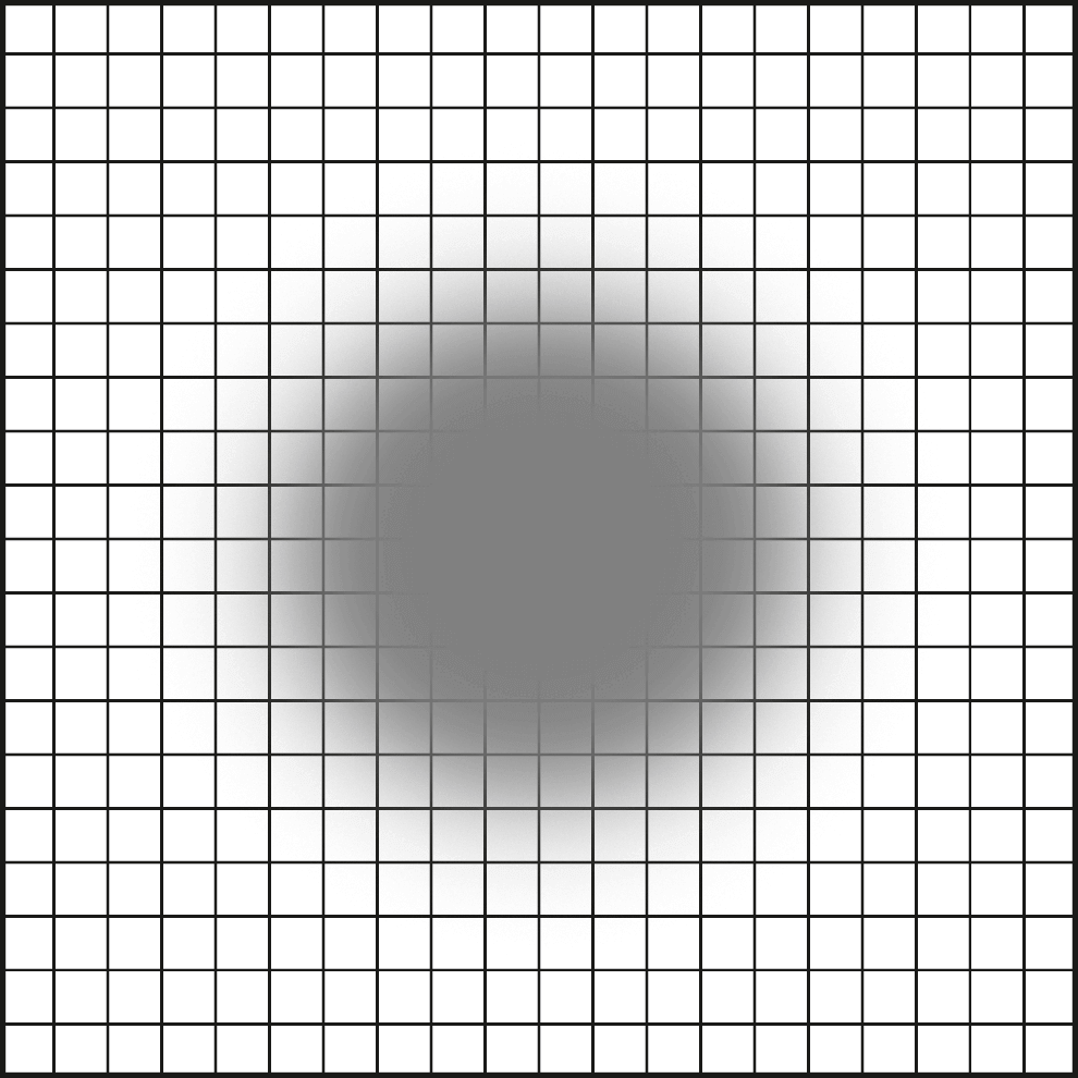 Amsler-Gitter-Test mit verschwommenen Bereiche und grauem Schatten.